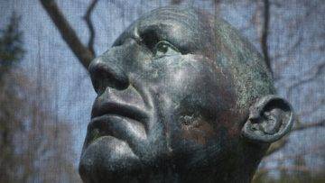 Top 10 People With The Most Unusual Skin Conditions