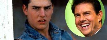 Top 10 Celebrities With The Worst Teeth (That Are Better Now)