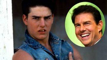 Top 10 Celebrities With The Worst Teeth (That Are Better Now)